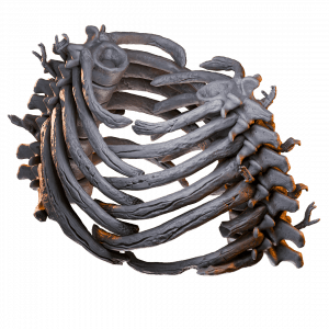 Bone Cage
