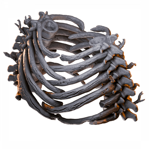 Bone Cage
